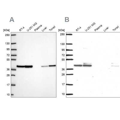 Western Blot: STRAP Antibody [NBP2-56502]