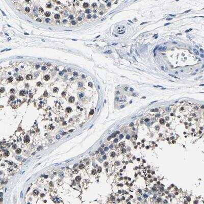 Immunohistochemistry-Paraffin: STRBP Antibody [NBP1-83754]