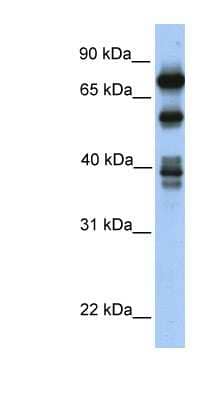 Western Blot: STRBP Antibody [NBP1-57311]