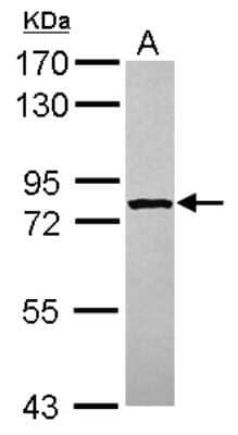 Western Blot: STRBP Antibody [NBP2-20522]