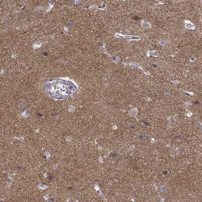 Immunohistochemistry-Paraffin: STRC Antibody [NBP2-68681]