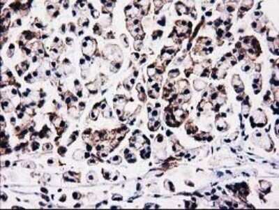 Immunohistochemistry: STRIP1 Antibody (OTI7B8) - Azide and BSA Free [NBP2-74408]