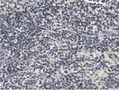 Immunohistochemistry: STRIP1 Antibody (OTI7B8) - Azide and BSA Free [NBP2-74408]