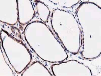 Immunohistochemistry: STRIP1 Antibody (OTI7B8) - Azide and BSA Free [NBP2-74408]