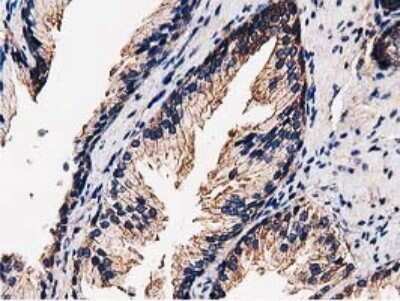 Immunohistochemistry: STRIP1 Antibody (OTI7B8) [NBP2-45715]