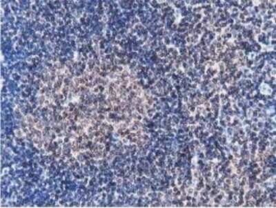 Immunohistochemistry: STRIP1 Antibody (OTI7B8) [NBP2-45715]