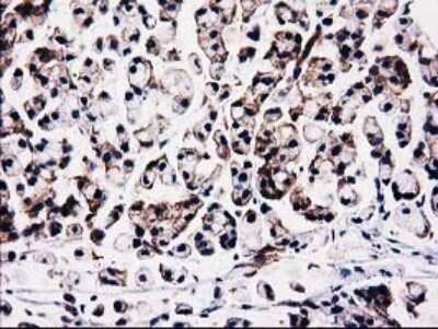 Immunohistochemistry: STRIP1 Antibody (OTI7B8) [NBP2-45715]
