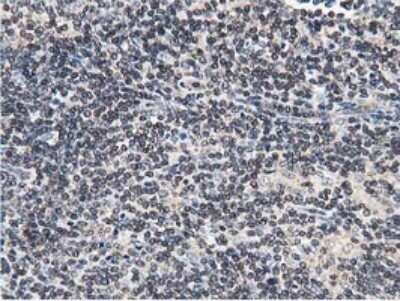 Immunohistochemistry: STRIP1 Antibody (OTI7B8) [NBP2-45715]