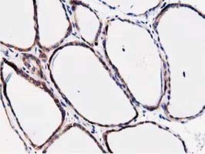 Immunohistochemistry: STRIP1 Antibody (OTI7B8) [NBP2-45715]