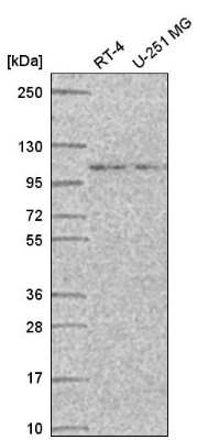 Western Blot: STRIP1 Antibody [NBP2-56570]