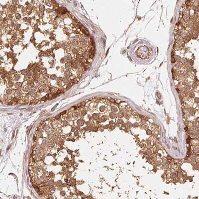 Immunohistochemistry: STRN4 Antibody [NBP2-49234]