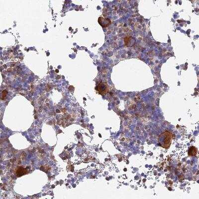 Immunohistochemistry-Paraffin: STRN4 Antibody [NBP1-93433]