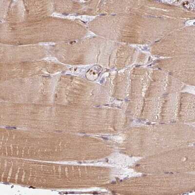 Immunohistochemistry-Paraffin: STRN4 Antibody [NBP2-49234]