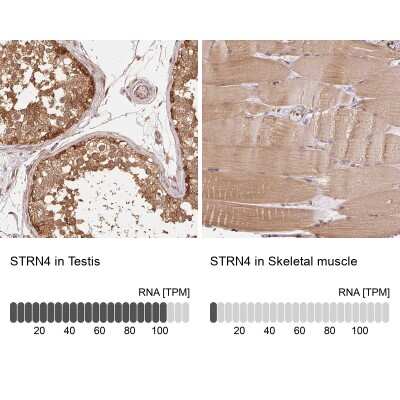 Immunohistochemistry-Paraffin: STRN4 Antibody [NBP2-49234]