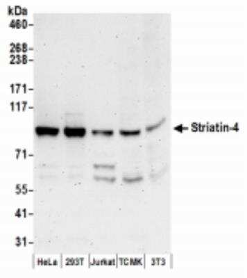 Western Blot: STRN4 Antibody [NBP2-36537]