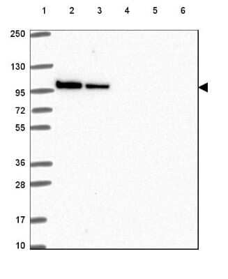 Western Blot: STRN4 Antibody [NBP2-49234]