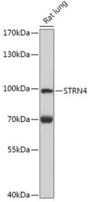 Western Blot: STRN4 AntibodyAzide and BSA Free [NBP3-04871]