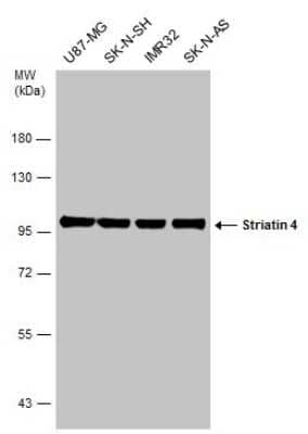 Western Blot: STRN4 Antibody [NBP3-13187]