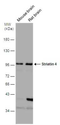 Western Blot: STRN4 Antibody [NBP3-13187]