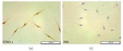 Immunocytochemistry: STRO-1 Antibody (STRO-1) - Azide and BSA Free [NBP2-80966]