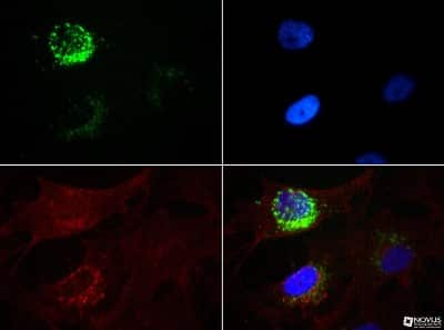 Immunocytochemistry/ Immunofluorescence: STRO-1 Antibody (STRO-1) [NBP1-48356]