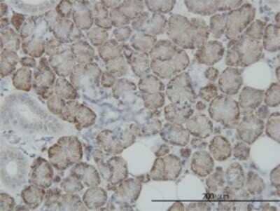 Immunohistochemistry-Paraffin: STT3A Antibody (4D4) [H00003703-M02]
