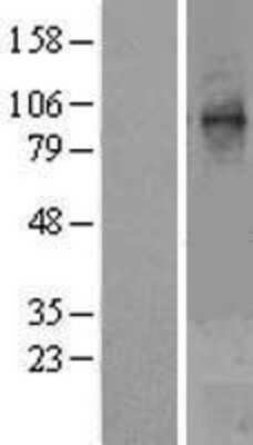 Western Blot: STT3A Overexpression Lysate [NBL1-16572]