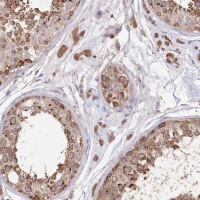 Immunohistochemistry: STT3B Antibody [NBP2-48657]