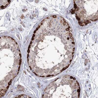 Immunohistochemistry-Paraffin: STT3B Antibody [NBP1-81884]