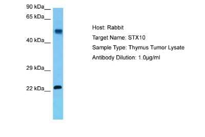 Western Blot: STX10 Antibody [NBP2-85842]