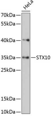 Western Blot: STX10 AntibodyAzide and BSA Free [NBP2-94692]