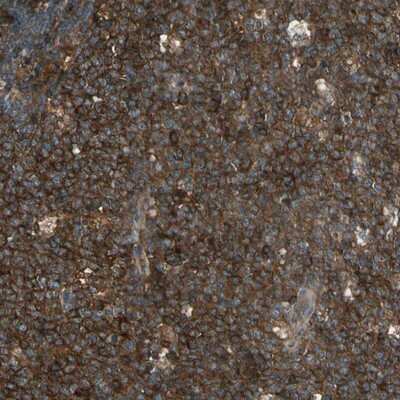 Immunohistochemistry-Paraffin: STX11 Antibody [NBP1-86122]