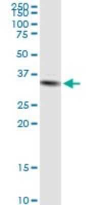 Western Blot: STX11 Antibody [H00008676-D01P]