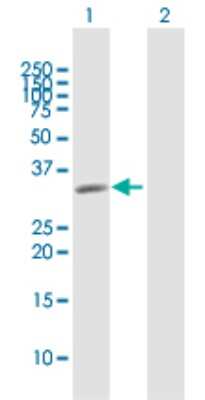Western Blot: STX11 Antibody [H00008676-D01P]