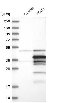 Western Blot: STX11 Antibody [NBP1-86122]