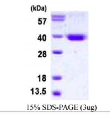 SDS-PAGE: Recombinant Human STX11 His Protein [NBP1-98974]