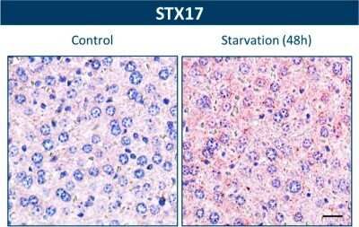 Immunohistochemistry: STX17 Antibody [NBP1-93968]