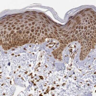 Immunohistochemistry-Paraffin: STX17 Antibody [NBP1-93968]