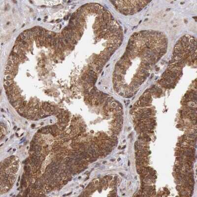 Immunohistochemistry-Paraffin: STX17 Antibody [NBP1-93968]