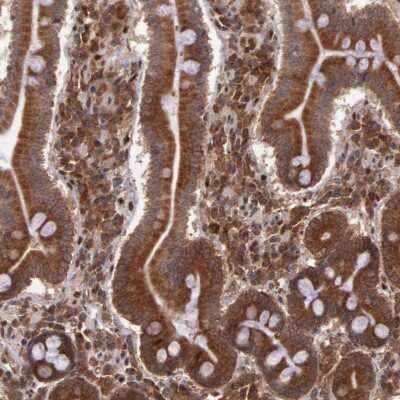 Immunohistochemistry-Paraffin: STX17 Antibody [NBP1-93968]