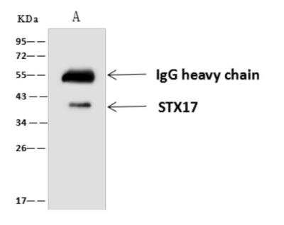 Immunoprecipitation: STX17 Antibody [NBP3-05995]