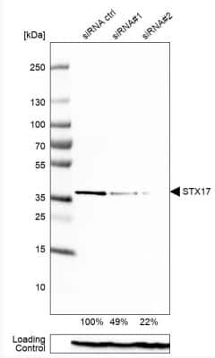 Western Blot: STX17 Antibody [NBP1-93968]