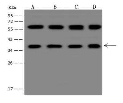 Western Blot: STX17 Antibody [NBP3-05995]