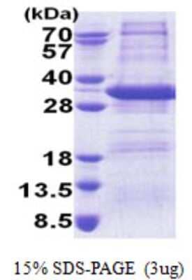 SDS-PAGE: Recombinant Human STX17 His Protein [NBP2-22842]