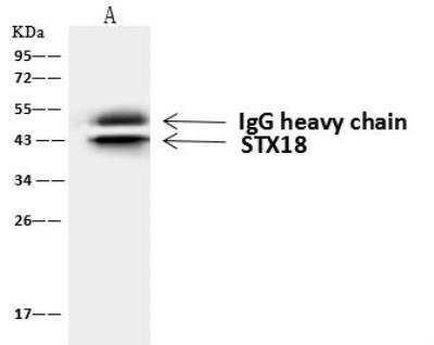 Immunoprecipitation: STX18 Antibody [NBP2-98545]