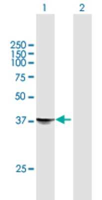 Western Blot: STX18 Antibody [H00053407-B01P]