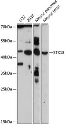 Western Blot: STX18 AntibodyBSA Free [NBP2-93340]