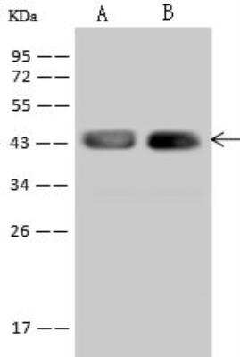 Western Blot: STX18 Antibody [NBP2-98545]