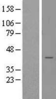 Western Blot: STX18 Overexpression Lysate [NBL1-16577]