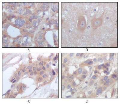 Immunohistochemistry-Paraffin: STYK1 Antibody (2H2F10) - BSA Free [NBP1-47511]